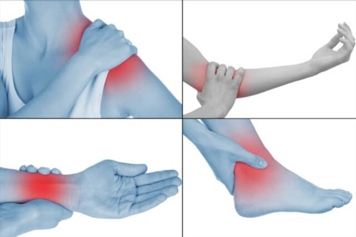 La Tendinitis Y Sus Tipos