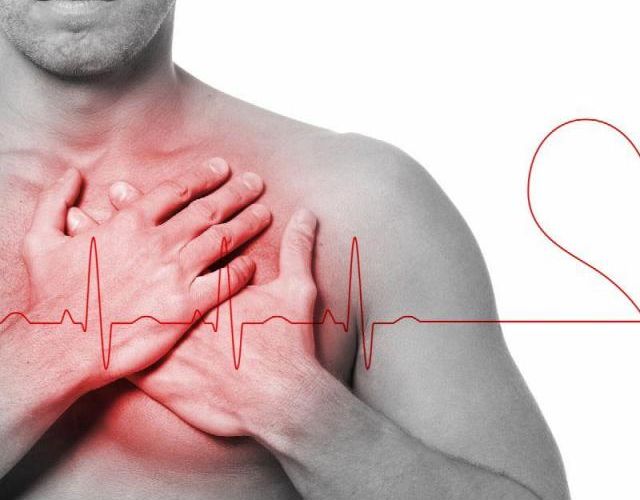 Arritmia cardíaca, síntomas y consejos