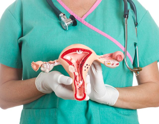 Miomas uterinos, ¿qué son?