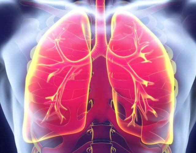 Tratamiento para líquido en los pulmones