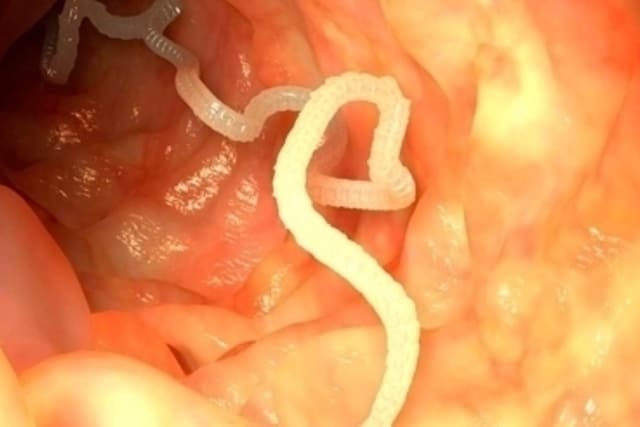 lombrices intestinales