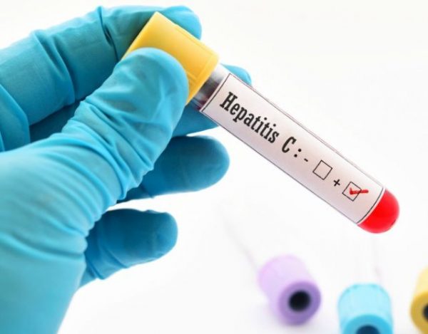 Cómo se contagia la hepatitis c