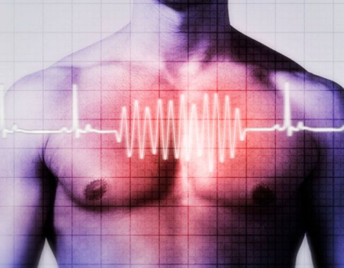 Causas Y Síntomas De Insuficiencia Mitral Y Sus Tratamientos 8107