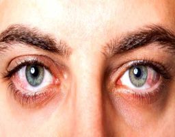 Causas comunes del dolor de ojos