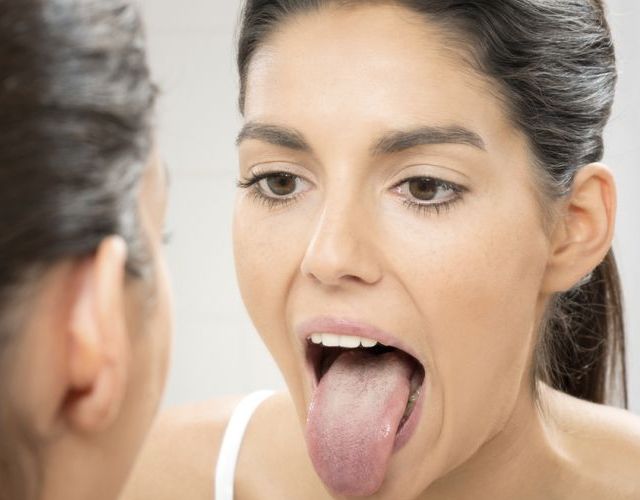 Hongos en la boca: síntomas y tratamientos