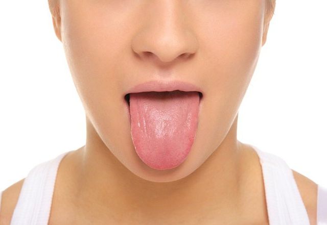 Cáncer de lengua síntomas y tratamiento