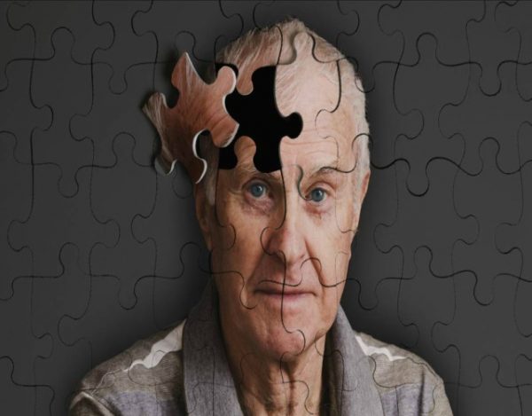 Alzheimer: Síntomas y causas