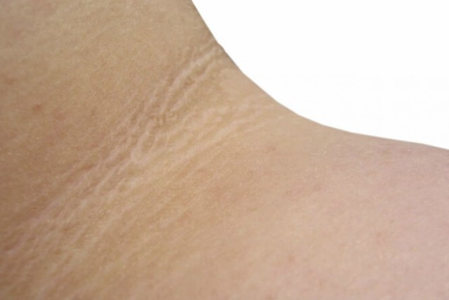 Causas de manchas oscuras en la piel