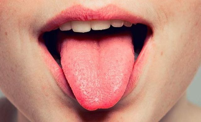 ampollas en la lengua