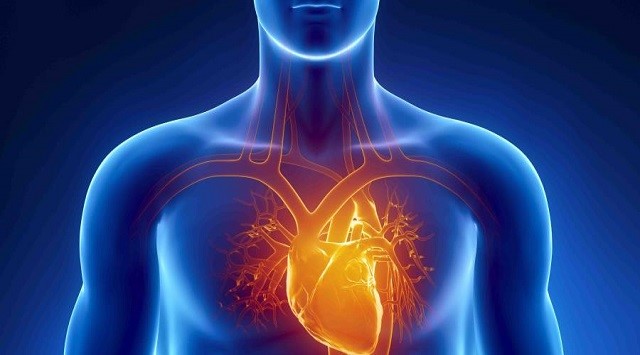 Cardiomegalia